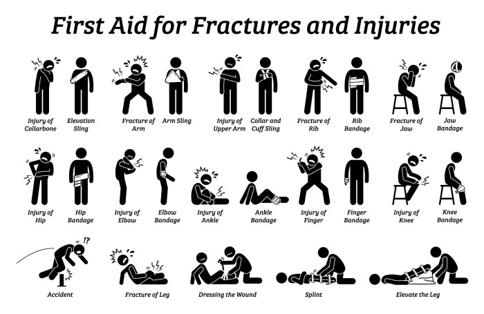 Aid broken bones fractures first bone fracture medical