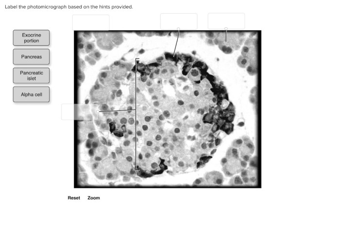 Label the histology of the ovary using the hints provided.