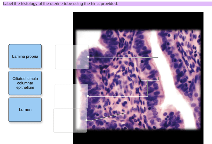 Label the histology of the ovary using the hints provided.